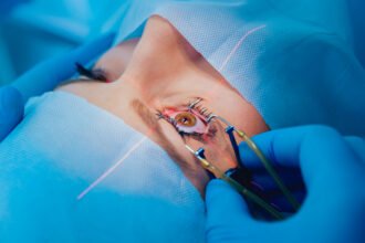 Laser μυωπίας ή γυαλιά και φακοί επαφής; Πλεονεκτήματα και διαφορές