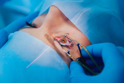 Laser μυωπίας ή γυαλιά και φακοί επαφής; Πλεονεκτήματα και διαφορές